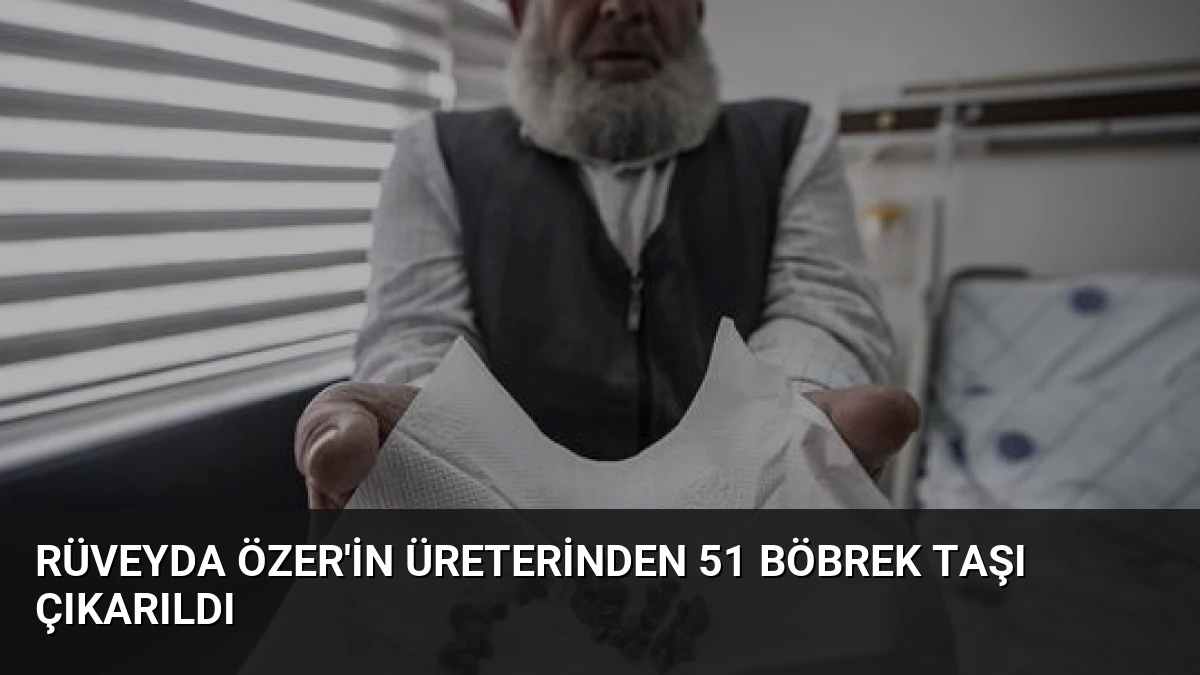 Rüveyda Özer’in Üreterinden 51 Böbrek Taşı Çıkarıldı